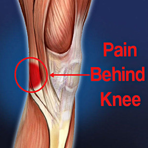 Pain-Behind-Knee-300x300